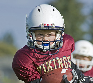 mouthguards